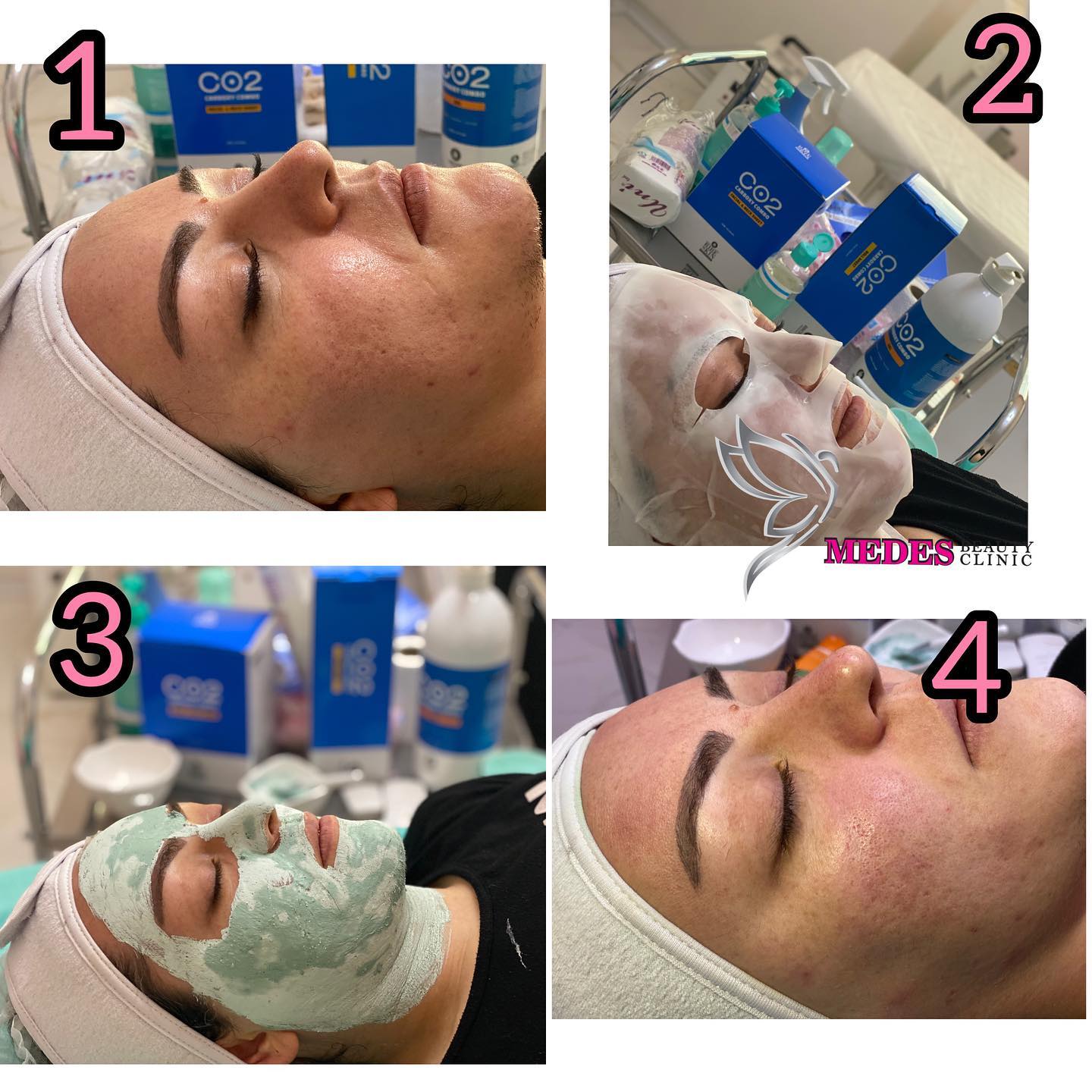 گالری کربوکسی تراپی